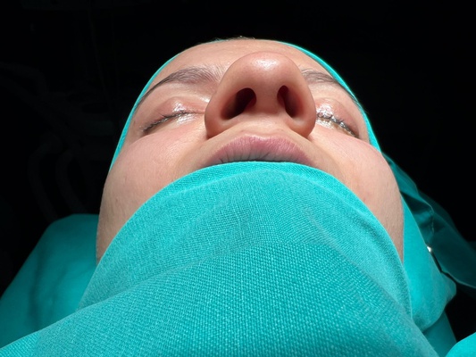 KBB